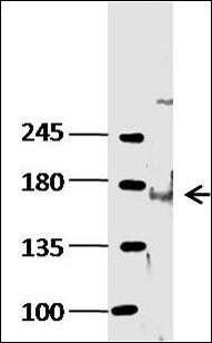 KDM6B antibody