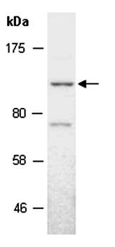 KDM7 antibody