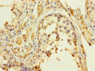 KDM8 Antibody