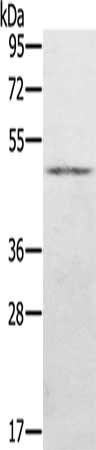 KDM8 antibody