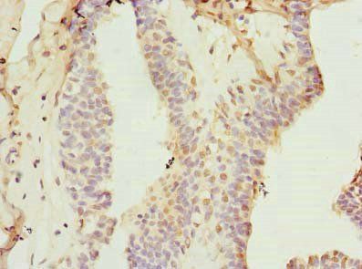 KEL Antibody