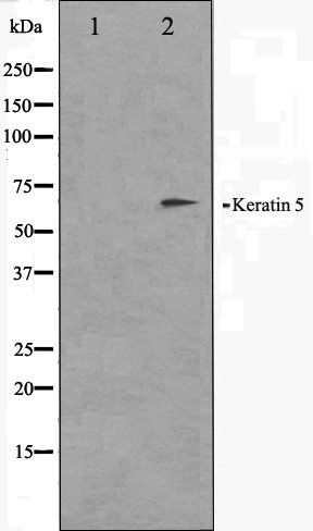 Keratin 5 antibody