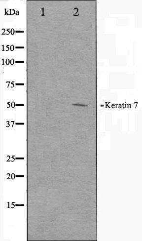 Keratin 7 antibody