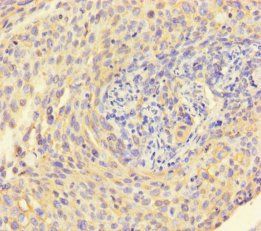 Keratin, type II cytoskeletal 6A antibody