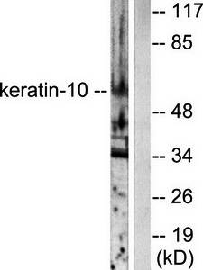 Keratin 10 antibody