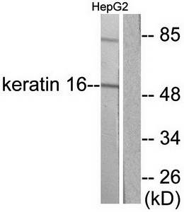 Keratin 16 antibody