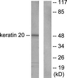 Keratin 20 antibody