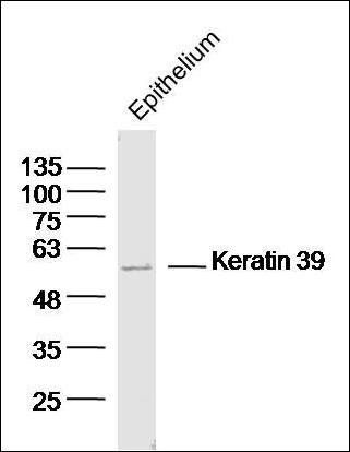 Keratin 39 antibody