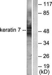 Keratin 7 antibody