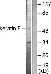 Keratin 8 antibody