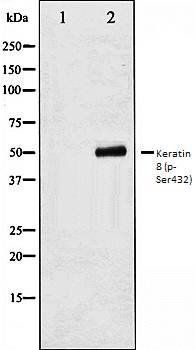Keratin 8 (phospho-Ser432) antibody