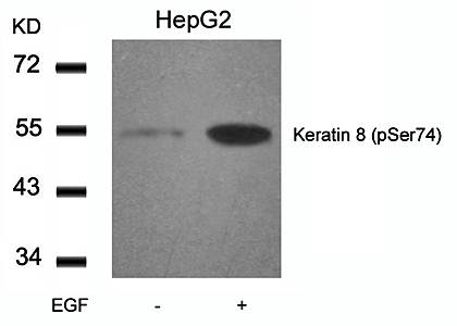 Keratin 8 (Phospho-Ser74) Antibody