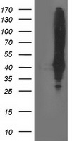 ketohexokinase (KHK) antibody