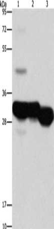 KHK antibody