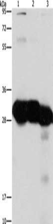 KHK antibody