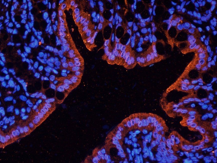 Ki67 Rabbit Polyclonal Antibody
