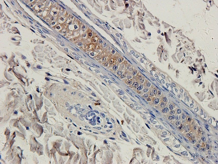 Ki67 Rabbit Polyclonal Antibody