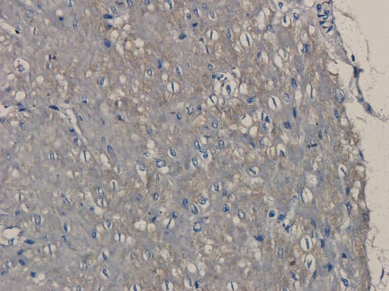 Ki67 Rabbit Polyclonal Antibody
