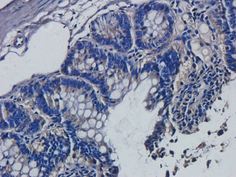 Ki67 Rabbit Polyclonal Antibody