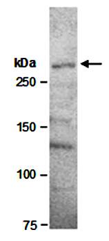 Ki67 (N2) Antibody, Rabbit Polyclonal