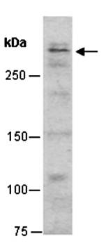 Ki67 (C1) Antibody, Rabbit Polyclonal