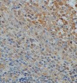 Ki67 Rabbit Polyclonal Antibody