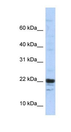 KIAA0040 antibody