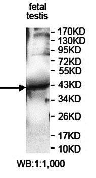 KIAA0174 Rabbit Polyclonal Antibody