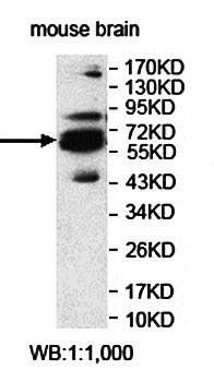 KIAA0284 Rabbit Polyclonal Antibody