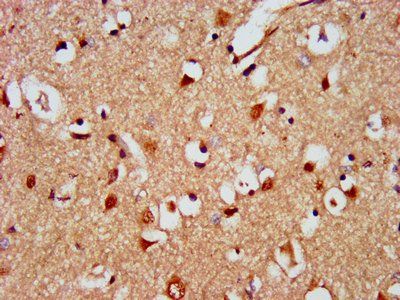 KIAA0319 Antibody