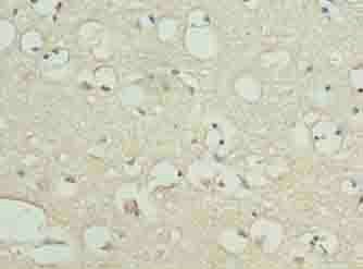 KIAA0319L Antibody