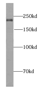 KIAA0430 antibody