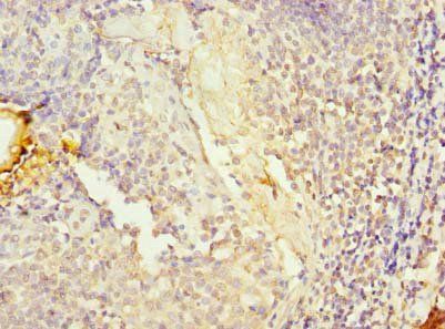 KHDC4 Antibody