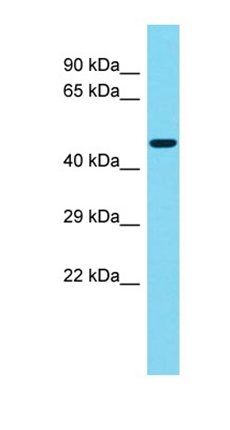 KIAA1257 antibody