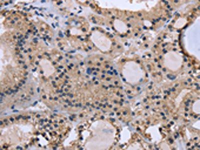 KIAA1324 antibody