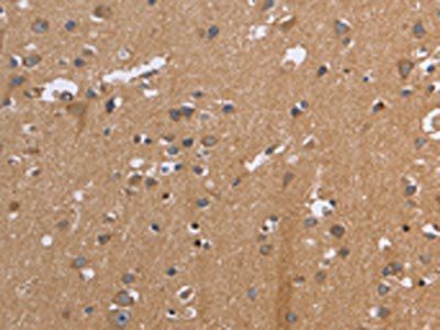 KIAA1324 Antibody