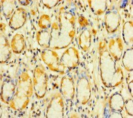 KIAA1324L antibody