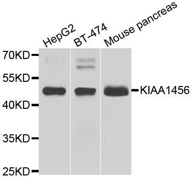 KIAA1456 antibody