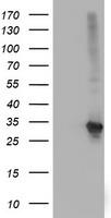 KIAA1609 (TLDC1) antibody