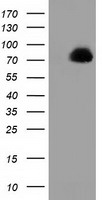 KIAA1609 (TLDC1) antibody