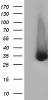 KIAA1609 (TLDC1) antibody