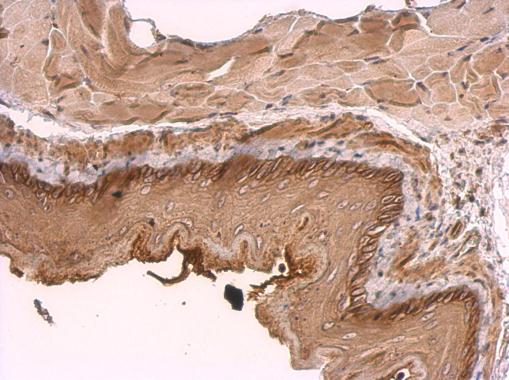 KIDINS220 Rabbit Polyclonal Antibody