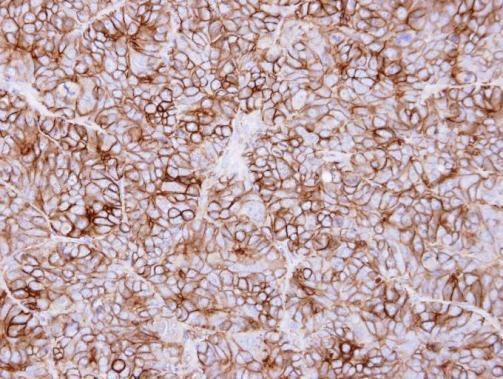 KIDINS220 Rabbit Polyclonal Antibody