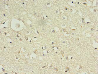 KIF12 Antibody