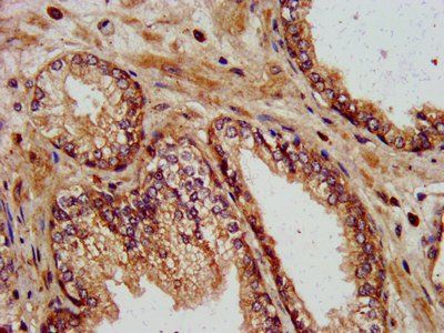KIF13B Antibody