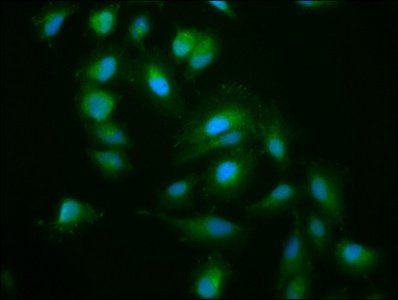 KIF15 antibody