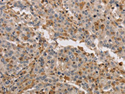 KIF17 antibody