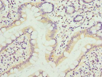 KIF1B Antibody