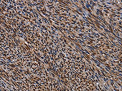 KIF1C Antibody