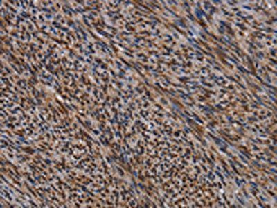 KIF1C antibody